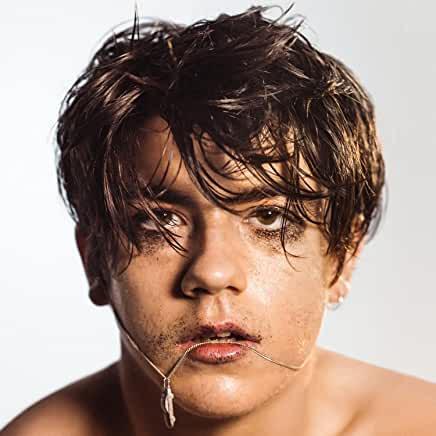 Declan McKenna- What Do You Think About The Car? (Clear/Yellow Vinyl) ( Vinyl )